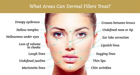 Dermal Fillers - The Beauty Clinic @ 70 Pitt St Sydney