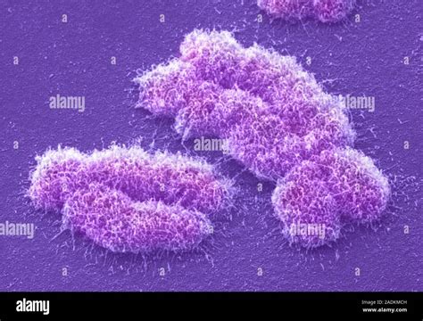 Human chromosomes. Coloured scanning electron micrograph (SEM) of two human chromosomes. Chromo ...