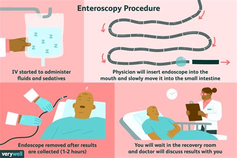 Enteroscopy: Uses, Side Effects, Procedure, Results