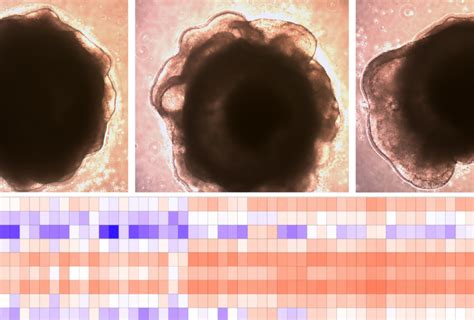 Sequencing trick identifies brain cells affected by large autism-linked ...