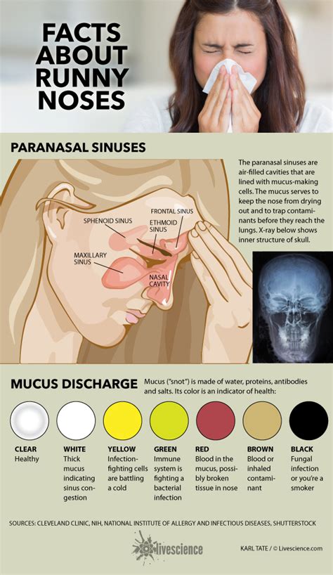 Different Color Discharge Chart