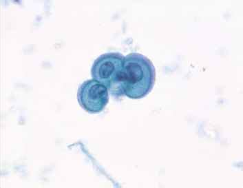 Normal Urothelial Histology and Cytology - Urothelial Cells