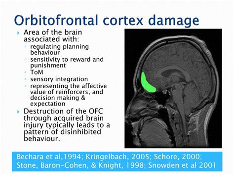 PPT - Challenges of working with a traumatic frontal lobe brain injury ...