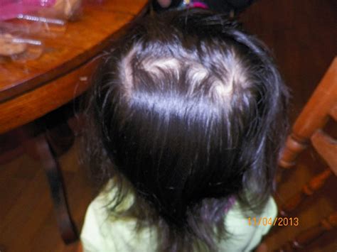 mygreatfinds: Both my daughters have double cowlicks/hair whorls!