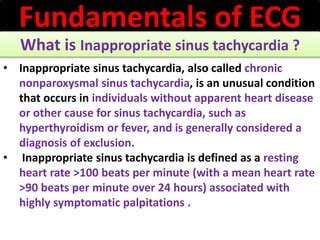 Approach to a patient with Heart rate abnormality in ECG | PPT