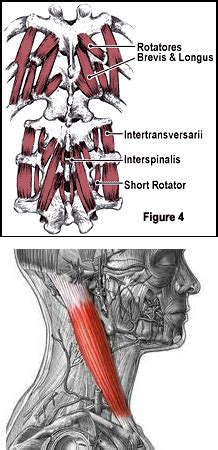 Neck Pain due to Muscle Spasm - Chiropractic Helps U Neck Pain 818-831-0100