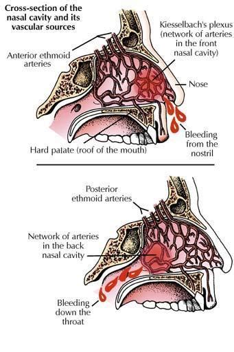 Epistaxis Basics : Anatomy, Physiology and Pathology | Epomedicine