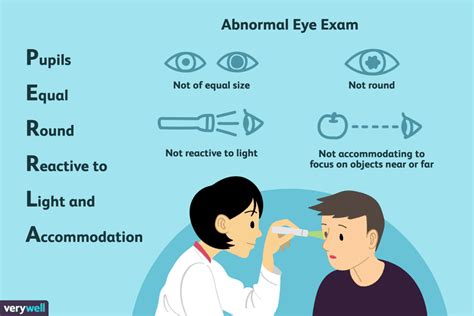 Special education #perrla #nursing #assessment perrla nursing ...