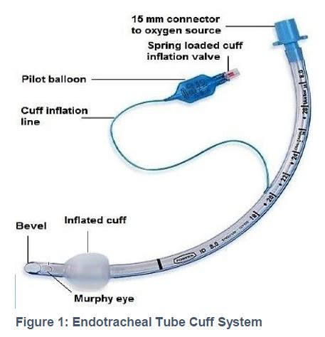 View of Endotracheal tube cuff pressure: An overlooked risk | Anaesthesia, Pain & Intensive Care