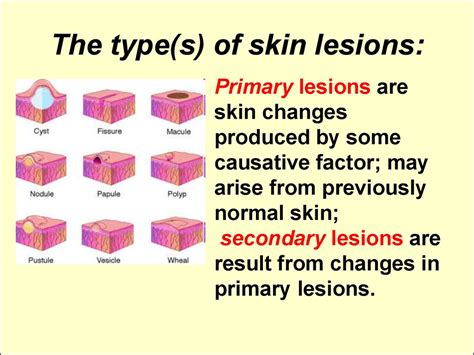 Skin Lesions Causes