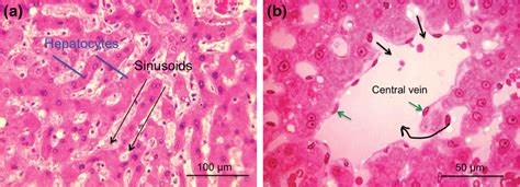 Liver Histology Sinusoids
