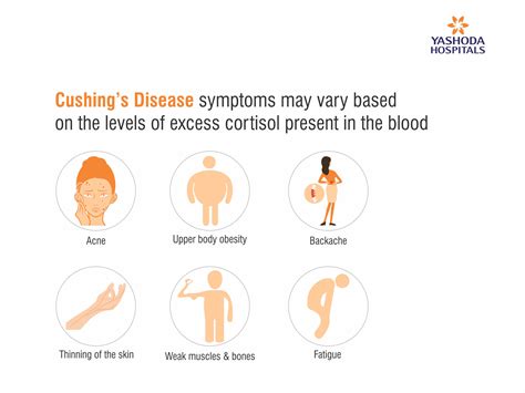 What is Cushing’s Disease? | Yashoda Hospitals | Symptoms & Treatment