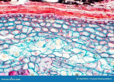 Cross Sections Of Plant Stem Under Microscope View Show Structure Of ...