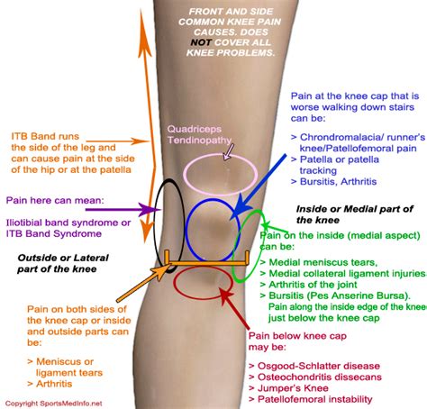 About Health: Knee pain