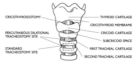 Tracheostomy Care- Indications|Types|Care