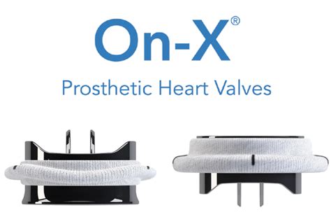 ON-x-header-980x506-02 - Heart Valve Choice