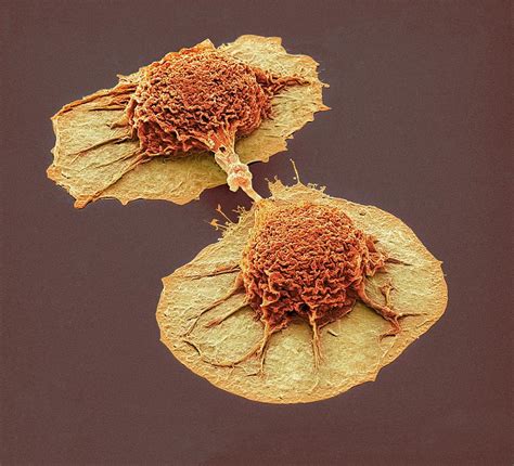 Dividing Lung Cancer Cells Photograph by Steve Gschmeissner - Fine Art America