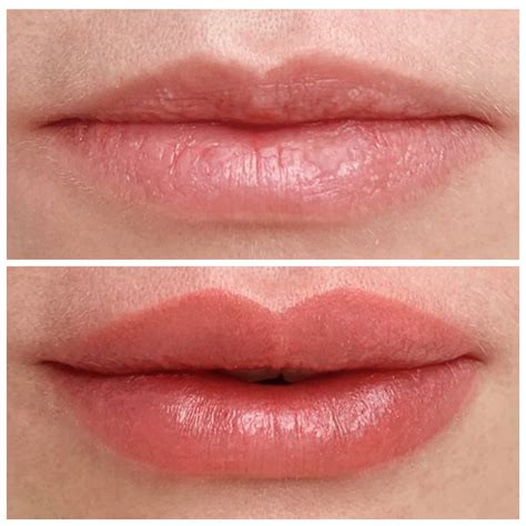 Can A Lip Tattoo Make Your Lips Bigger? | LA Klinic