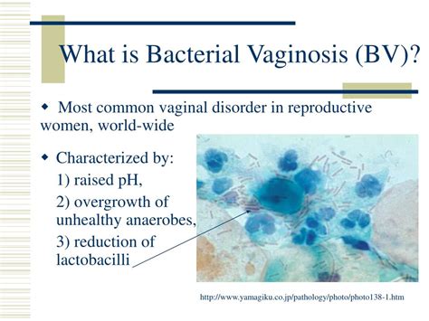 PPT - The Complexity of Bacterial Vaginosis: PowerPoint Presentation ...