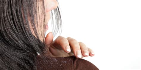 How Dandruff Shampoo Works | ReviewThis