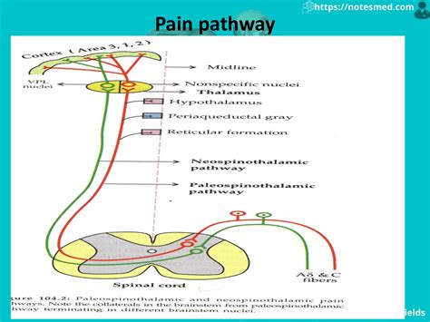 Physiology Of The Pain: Pathway, Types, Referred Pain | NotesMed