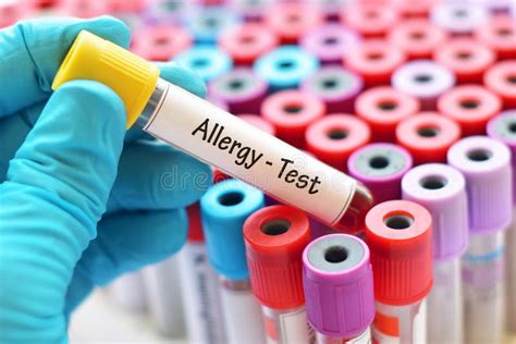 Blood for allergy test stock image. Image of tubes, experiment - 109133003