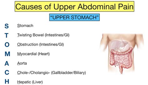 Abdominal Pain Causes: The Upper Stomach Trick and Examples — EZmed