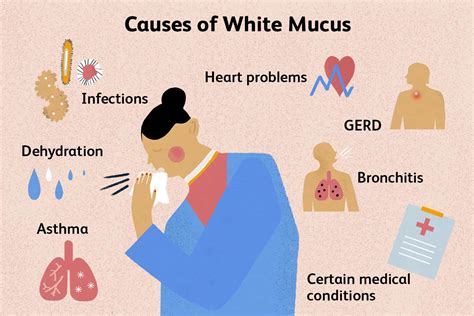 Top 10 coughing up thick white mucus 2022