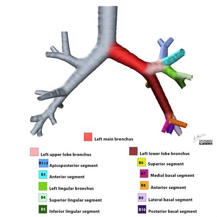 Lingula (lung) | Radiology Reference Article | Radiopaedia.org