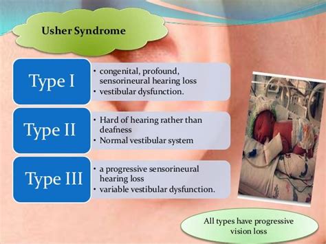 Usher syndrome causes - sandvertical