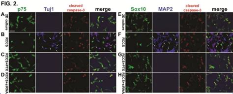 Decreased expression of neural crest markers and increased expression ...