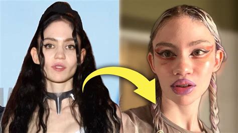 Grimes Admits to Plastic Surgery: the Start of the Era of Plastic Surgery Transparency?