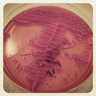 E.coli growing from a urine culture. | Science | Pinterest | Microbiology