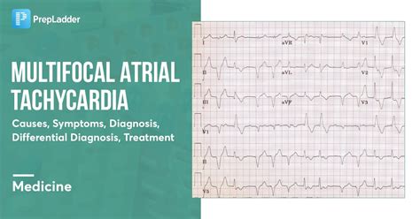 Multifocal Atrial Tachycardia : Causes, Symptoms, Diagnosis