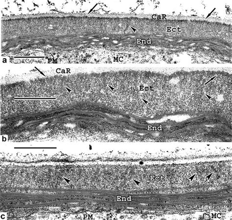 Late tetrad stage in progress in L. decidua. a In the ectexine (Ect),... | Download Scientific ...