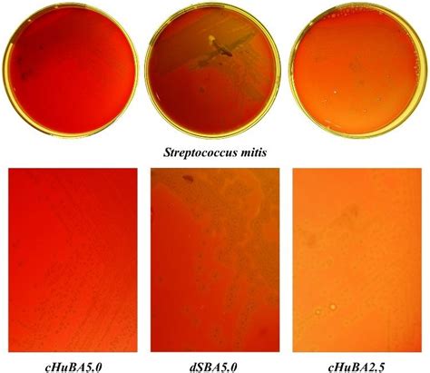 Growth of Streptococcus mitis on the three different blood agars. | Download Scientific Diagram