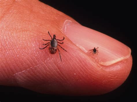 Lyme Disease – Know the Signs and Symptoms