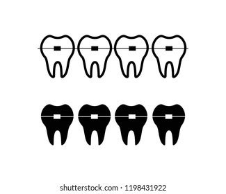 Braces Before After Orthodontics Dental Clinic Stock Vector (Royalty Free) 1730950609 | Shutterstock