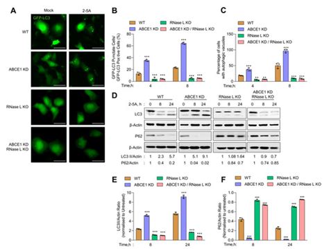 Viruses | Special Issue : Interferons in Viral Infections