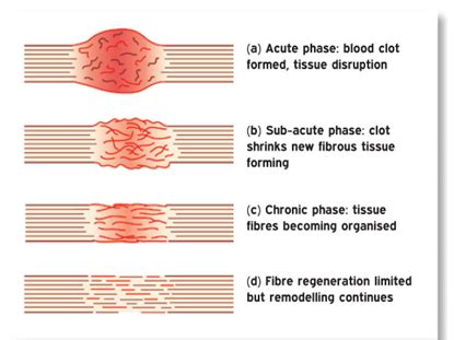 Soft tissue injury recovery - GC Hand Therapy