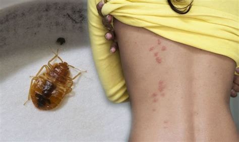 Bed bugs: Four signs you may have been bitten and how to get rid of an ...
