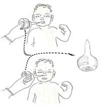 [Solved] While suctioning newborn babie's mouth and nose which&nb