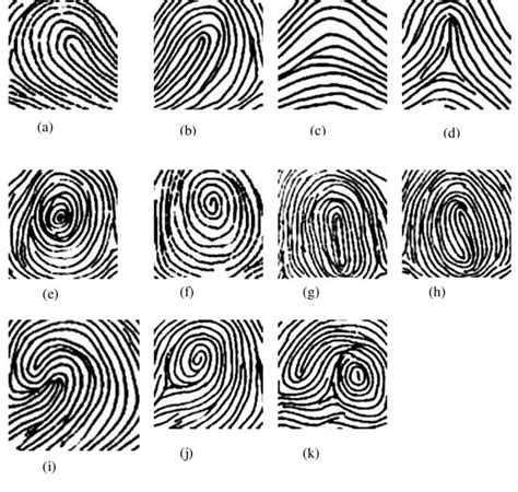 3: Basic patterns of fingerprints-(a) Ulnar Loop (b) Radial Loop (c)... | Download Scientific ...