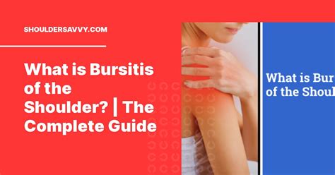 Shoulder Bursitis Causes | Porn Sex Picture