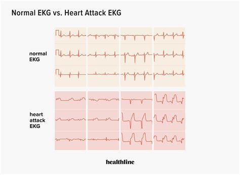 ekg test around me - Golden Memoir Photo Gallery