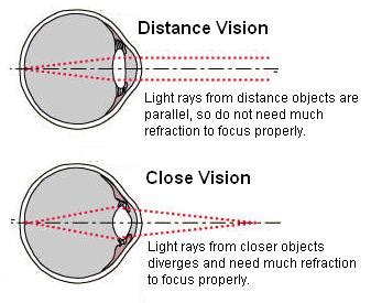 Refraction in the Eye