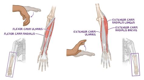 Hand Of Benediction Vs Ulnar Claw