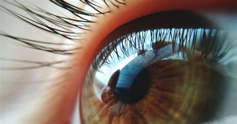 Eyelash Mites: Symptoms, Causes, and Treatments