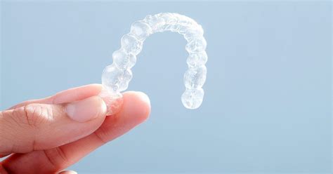 What the Invisalign Process Actually Looks Like in Practice