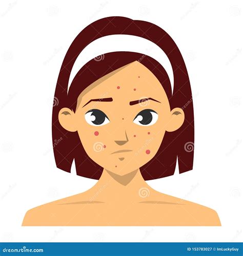 Facial Problem Of Acne, Pimples, Wrinkles Cartoon Vector ...